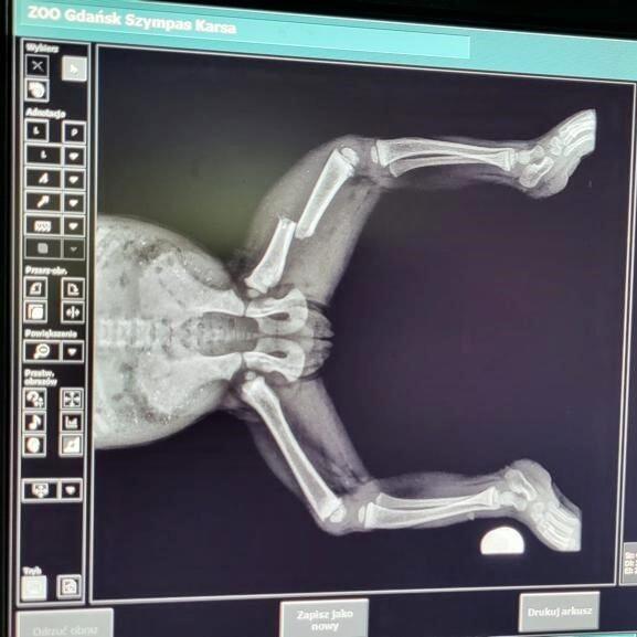 Zdjęcie rentgenowskie miednicy i kości nóg szympansa 