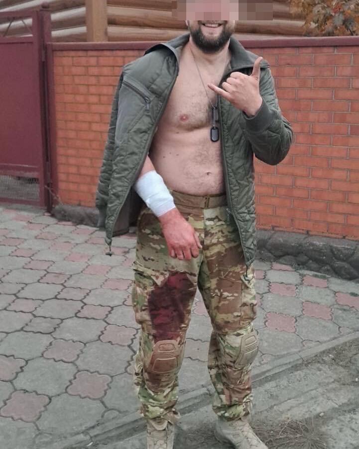 Żołnierz, stoi w mundurze, ma rozpiętą bluzę - na ręce opatrunek, nogawka spodni zakrwawiona