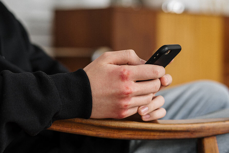Dłonie z krwawymi znakami na knykciach trzymają telefon.