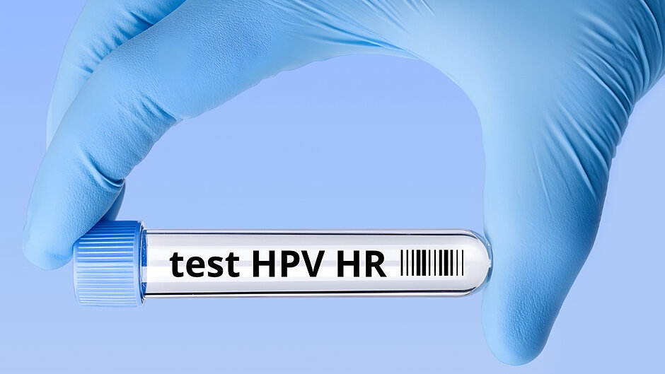 NOWE Profilaktyka raka szyjki macicy. Test HPV HR zamiast cytologii