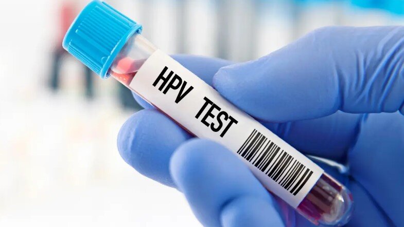 Fiolka testu HPV trzymana w dłoni która ubrana jest w niebieską lateksową rękawiczkę